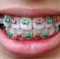 dr. Lantos Béla - fogorvos - foggyógyász - fájdalommentes fogászat, fogszabályzás