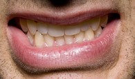 dr Lantos Béla foggyógyász - erőlködés közben összeszorított fogak